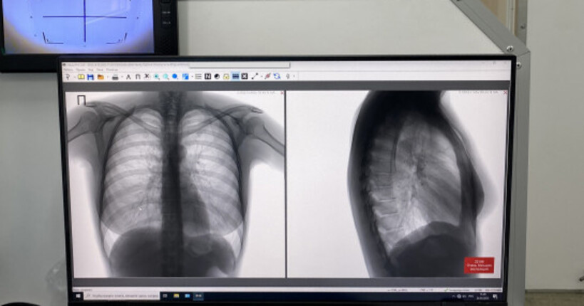 В Новосибирской области снизилась заболеваемость туберкулёзом