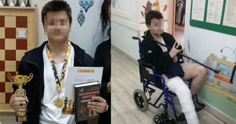 мальчик со сломаной ногой